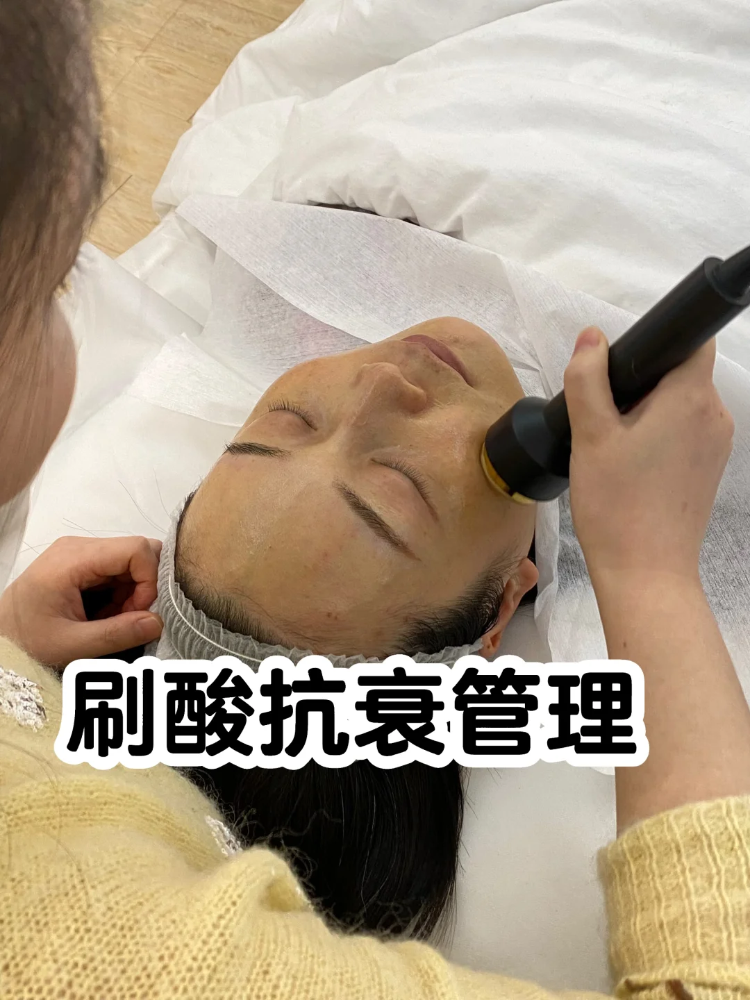 常德刷酸抗衰|28天素颜发光攻略✨