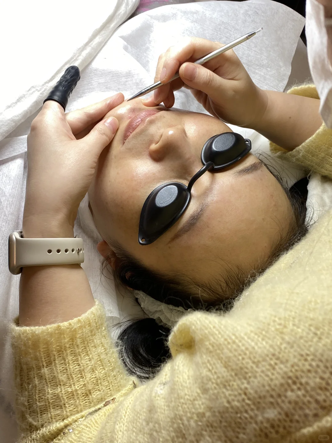 常德刷酸抗衰|28天素颜发光攻略✨