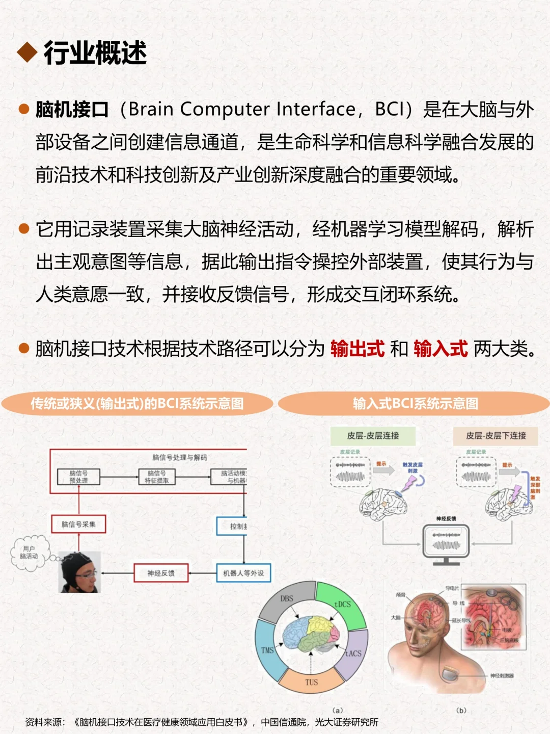 一天搞懂一个行业：脑机接口