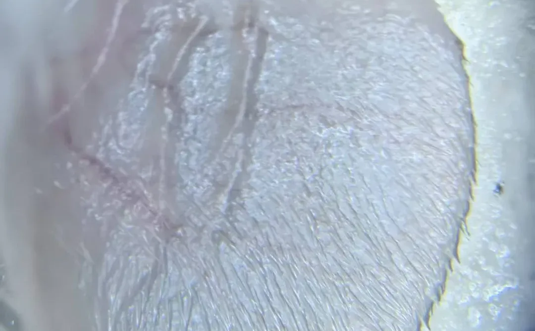 寒热对小鼠耳廓微循环的实验观察报告