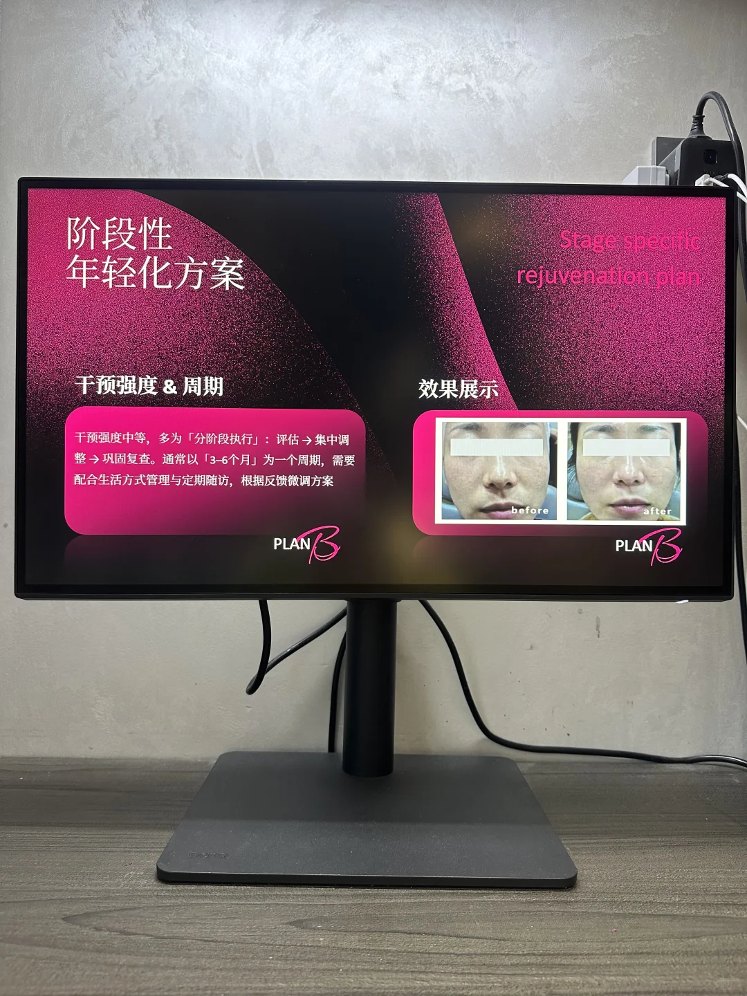 医美发布会怎么讲?这份发布会模版直接套