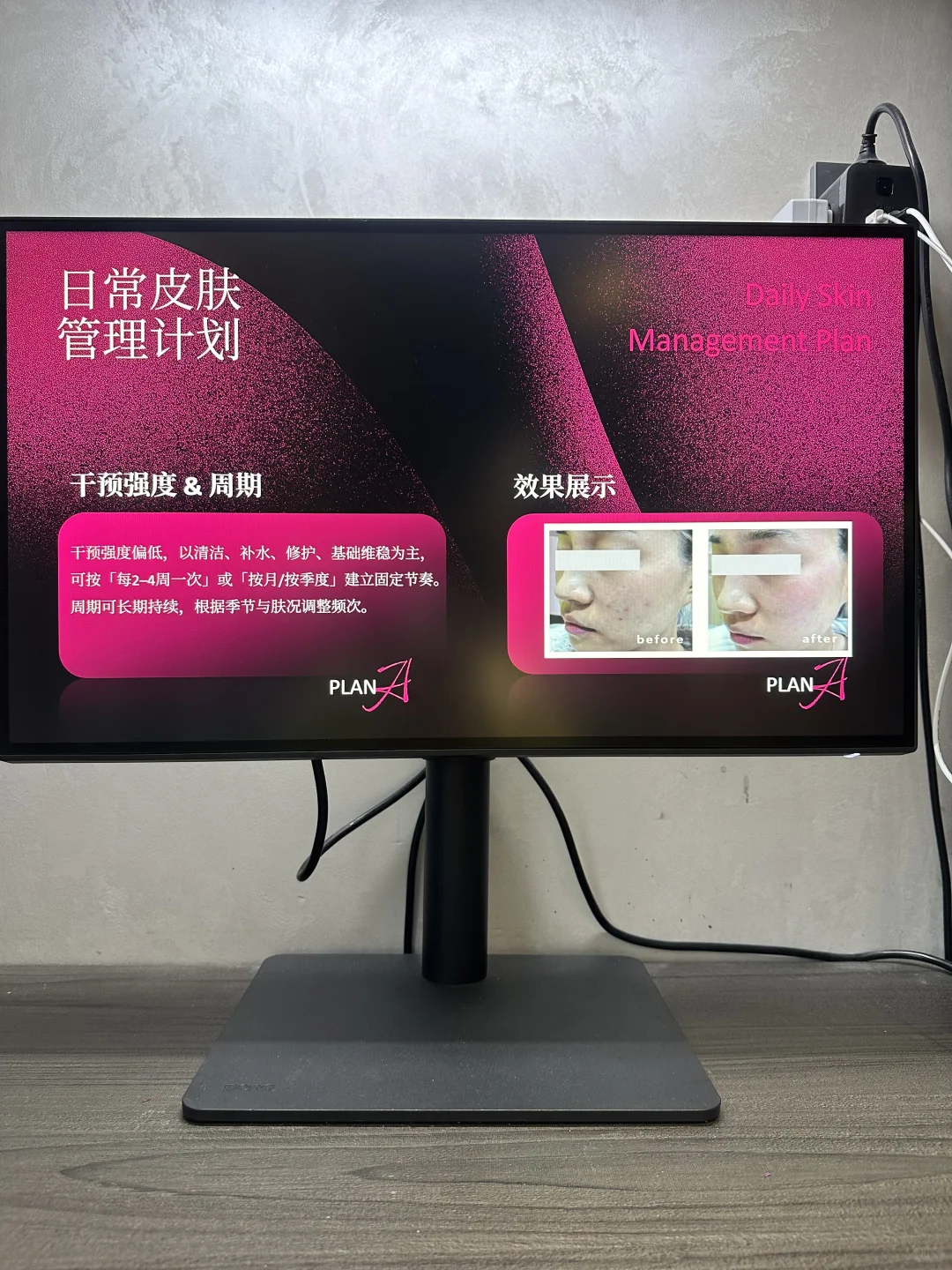 医美发布会怎么讲?这份发布会模版直接套