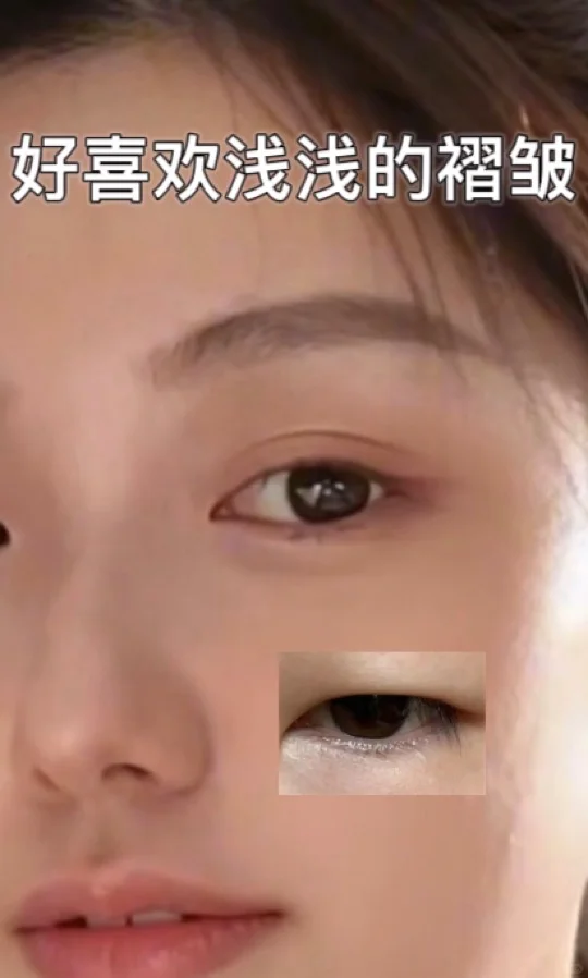 被我挖到了!肿眼泡的“夜间眼皮教练”?️