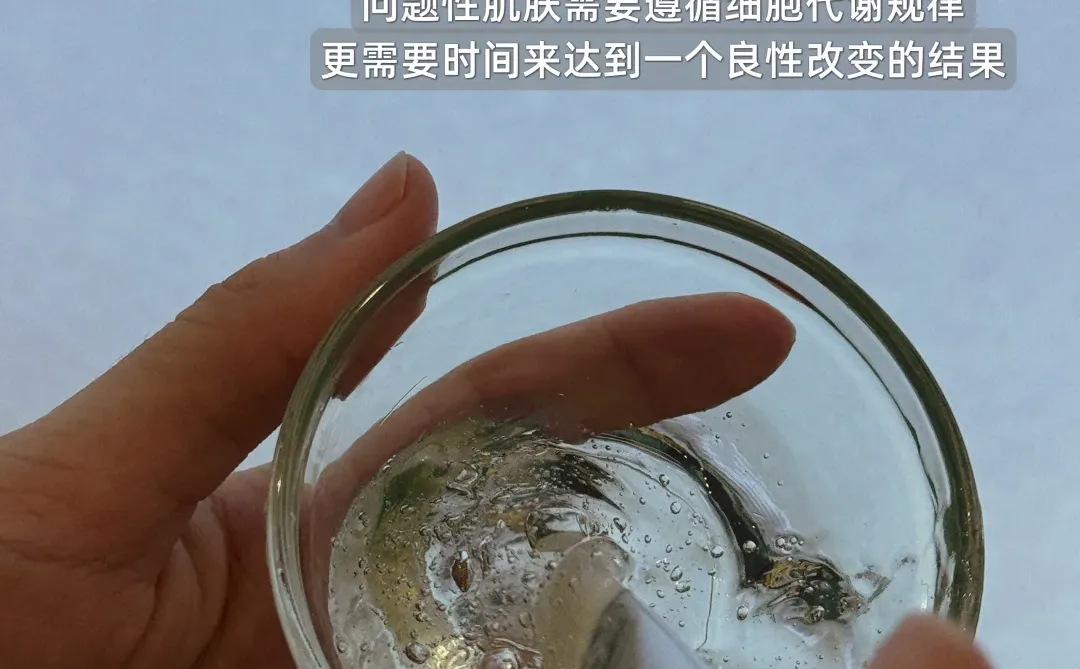 江门姐妹抄作业啦！干敏肌冬季水润上岸?