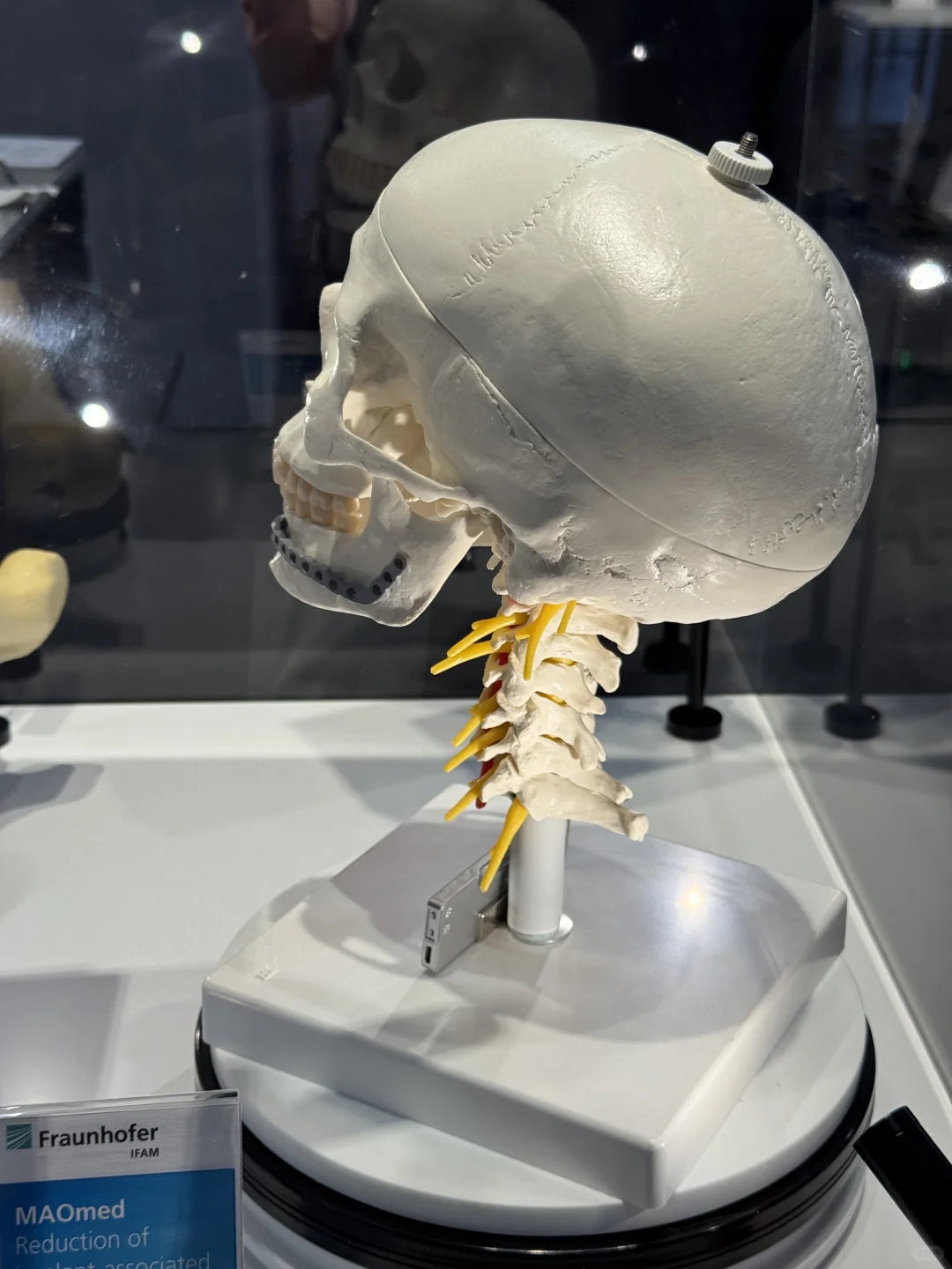 关于MEDICA2025的一些观察与感想（一）