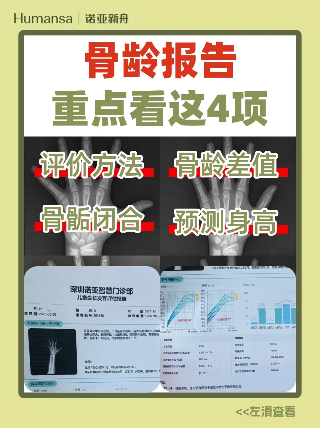 ⁉️孩子的?龄报告 你真的看懂了吗？