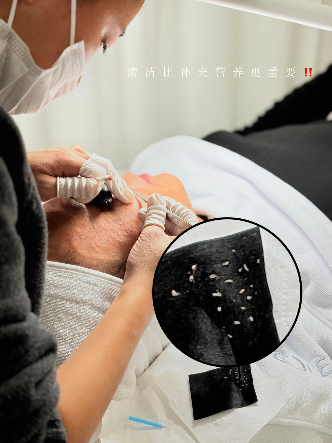 美容师真心话：清洁才是护肤的地基