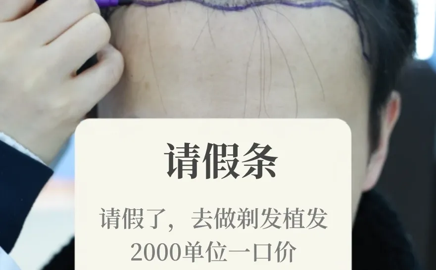 不用请假丨不剃发植发【案例版】低至6k！戳