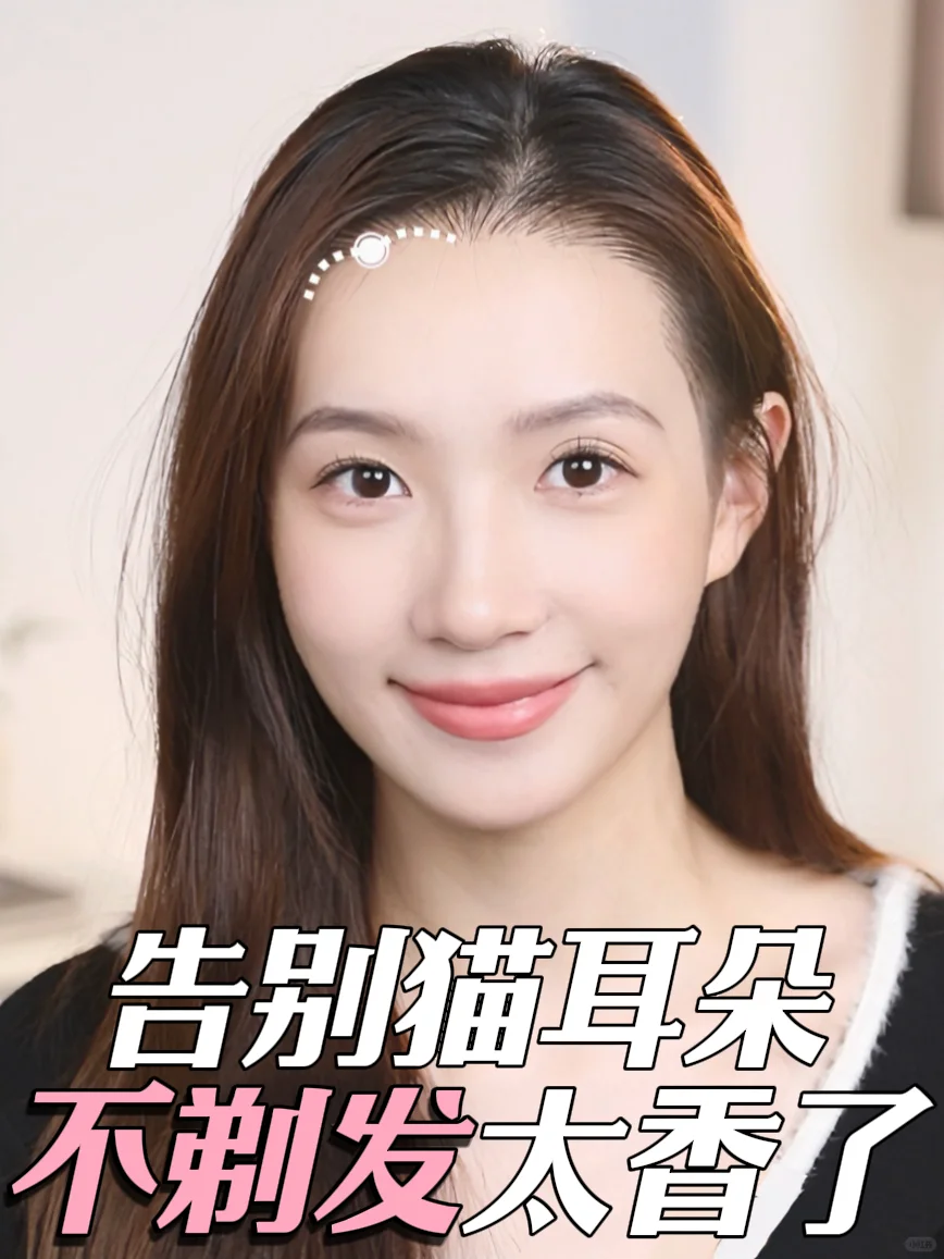 全网蹲🔥想做不剃发植发的姐妹必冲❗