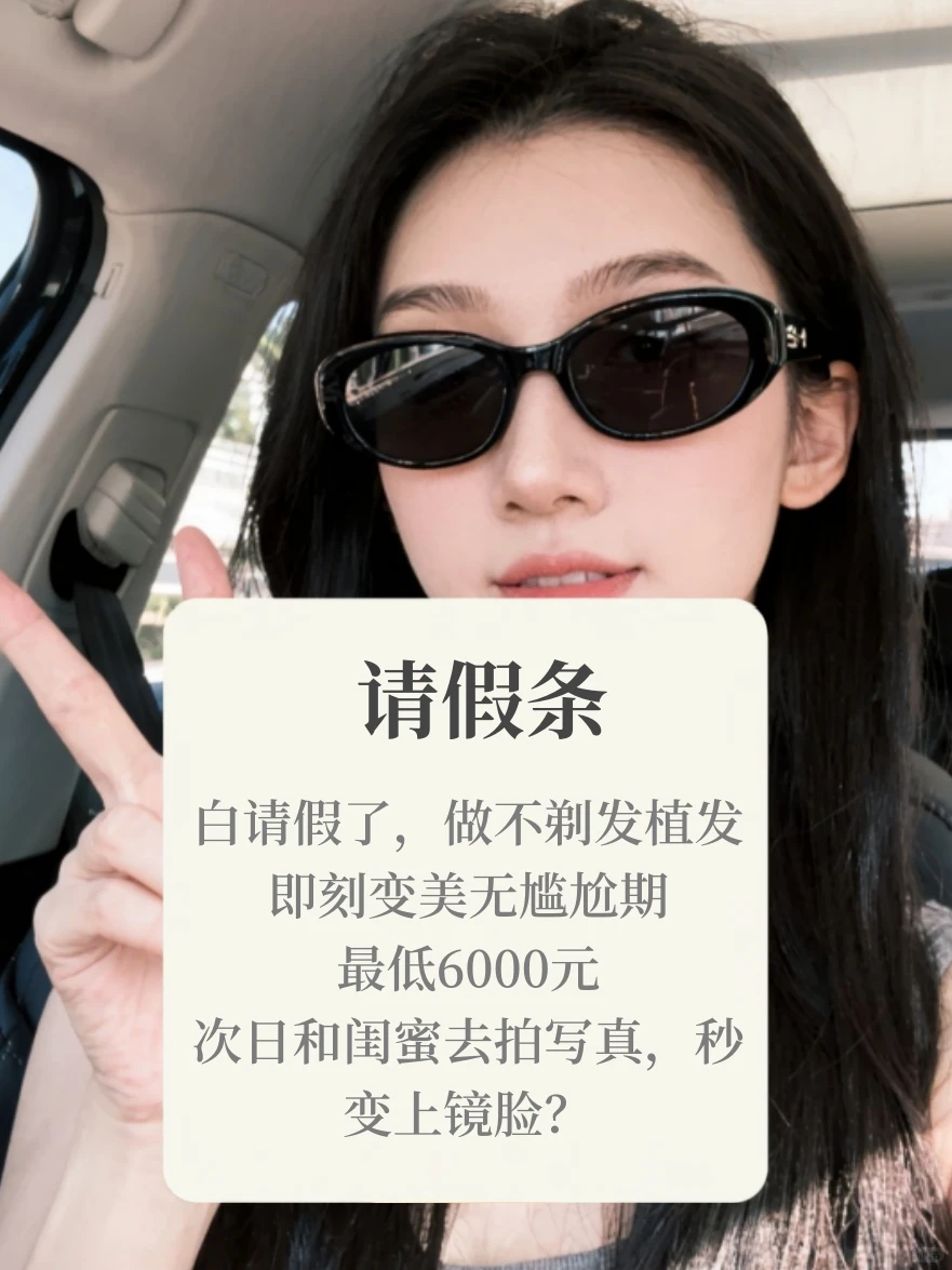 不用请假丨不剃发植发【案例版】低至6k！戳