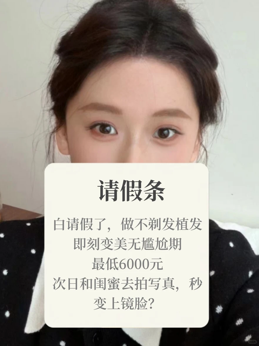 不用请假丨不剃发植发【案例版】低至6k！戳