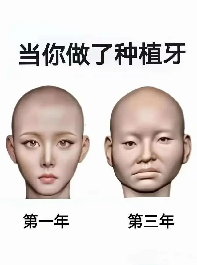 三甲已离职，平等的骂醒每个想做种植牙的……