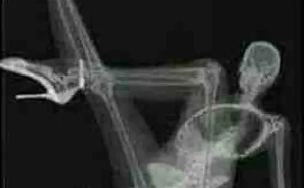 放射科妹子给男友发的果照，就问你性不性感？