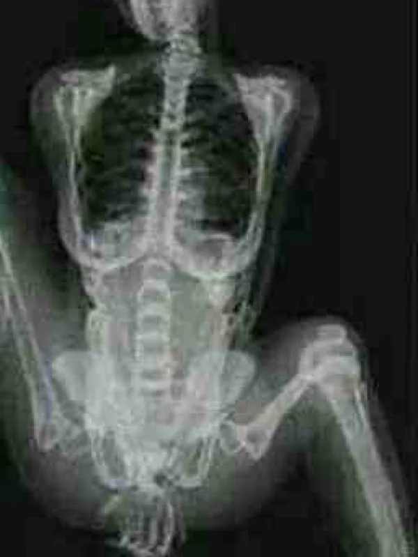 放射科妹子给男友发的果照，就问你性不性感？