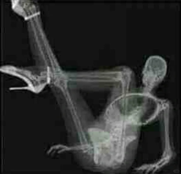 放射科妹子给男友发的果照，就问你性不性感？