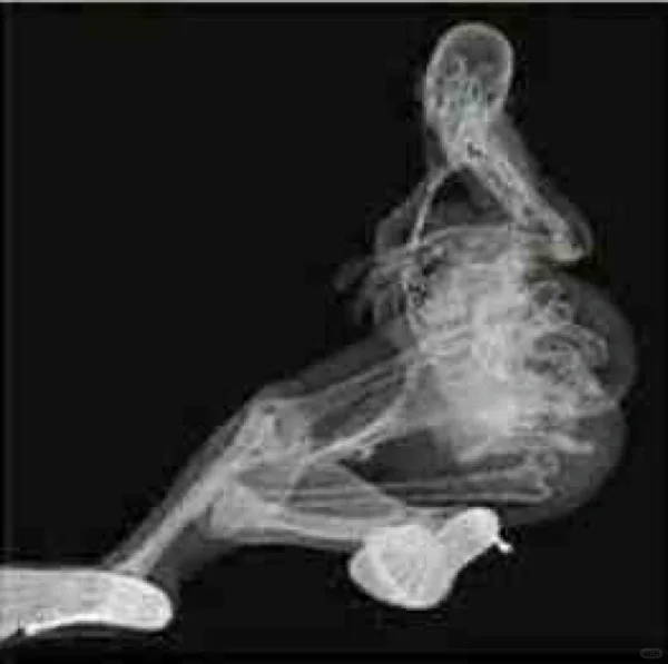 放射科妹子给男友发的果照，就问你性不性感？