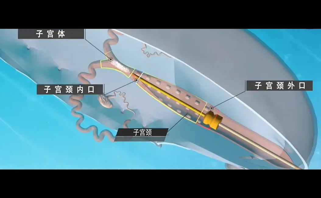 后备母猪为什么不采取深部输精？