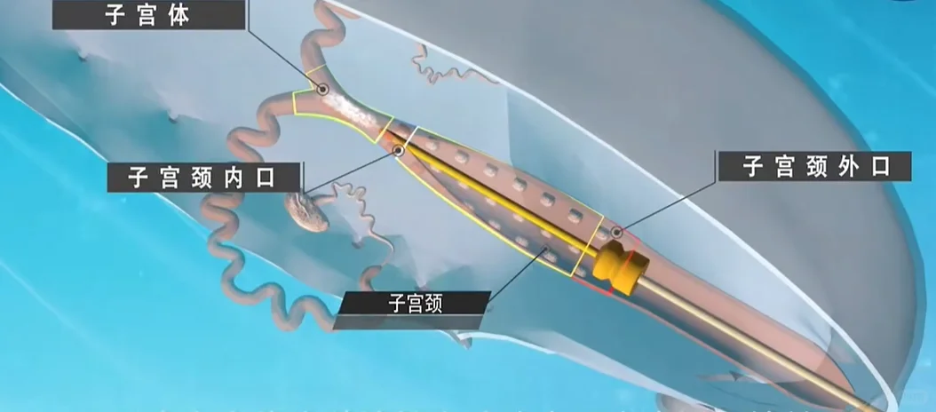 后备母猪为什么不采取深部输精？