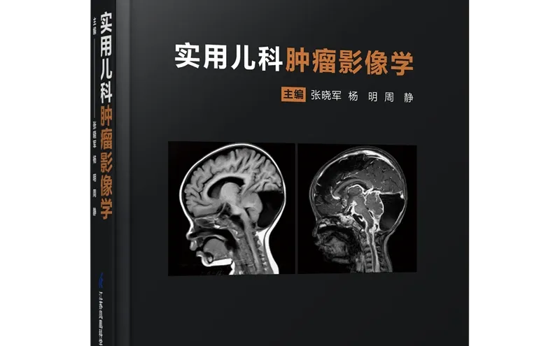 实用儿科肿瘤影像学pdf版电子书下载