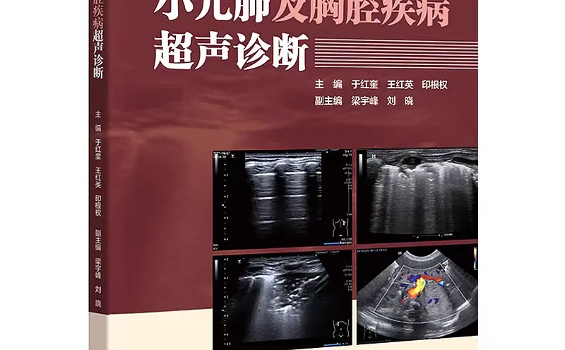 小儿肺及胸腔疾病超声诊断电子书下载