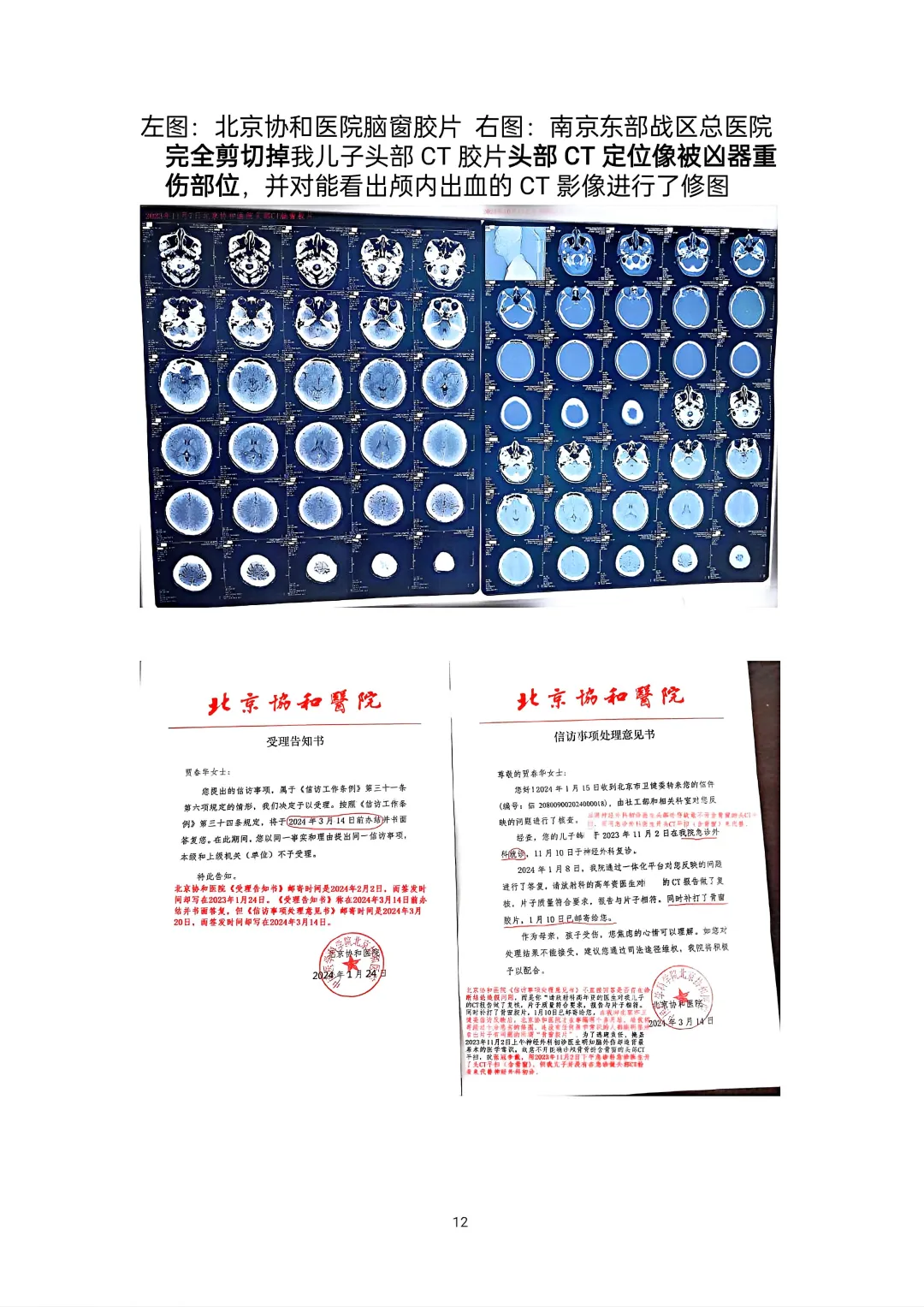 北京协和医院头部CT影像及诊断造假