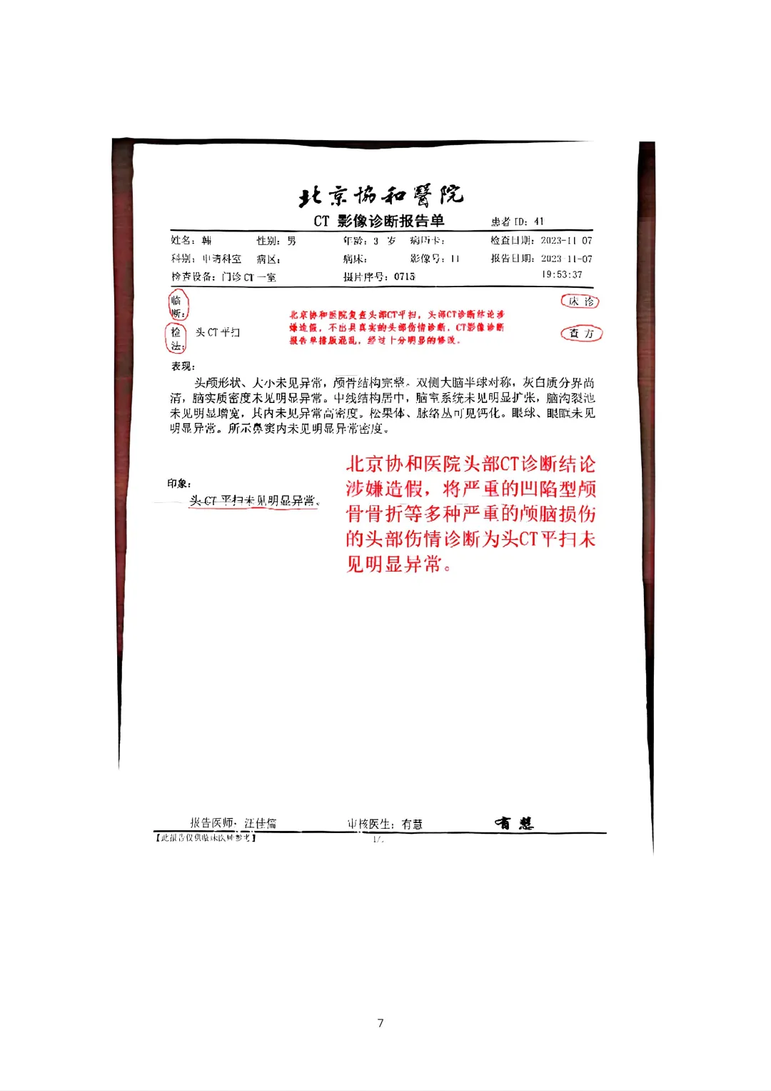 北京协和医院头部CT影像及诊断造假