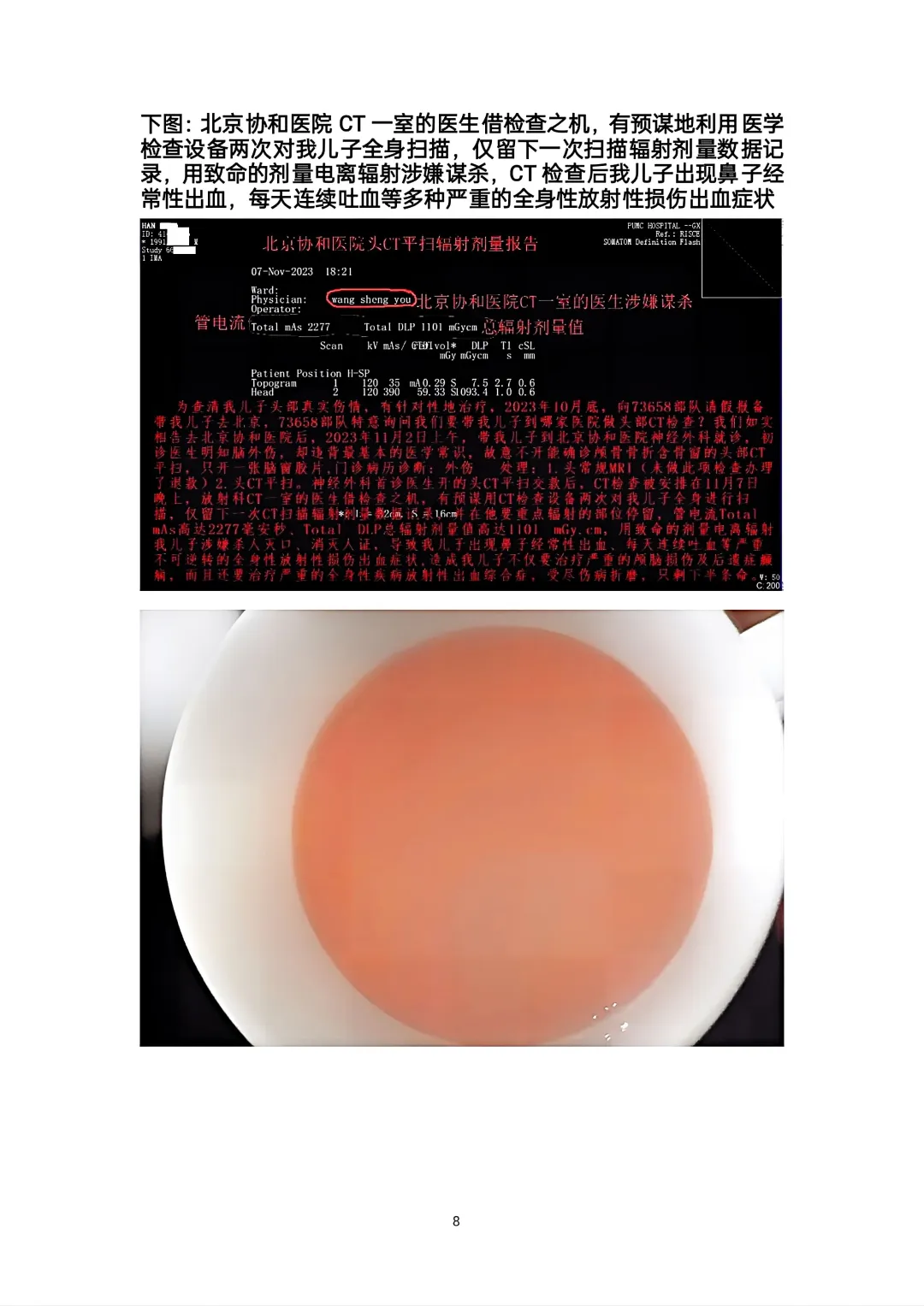 北京协和医院头部CT影像及诊断造假