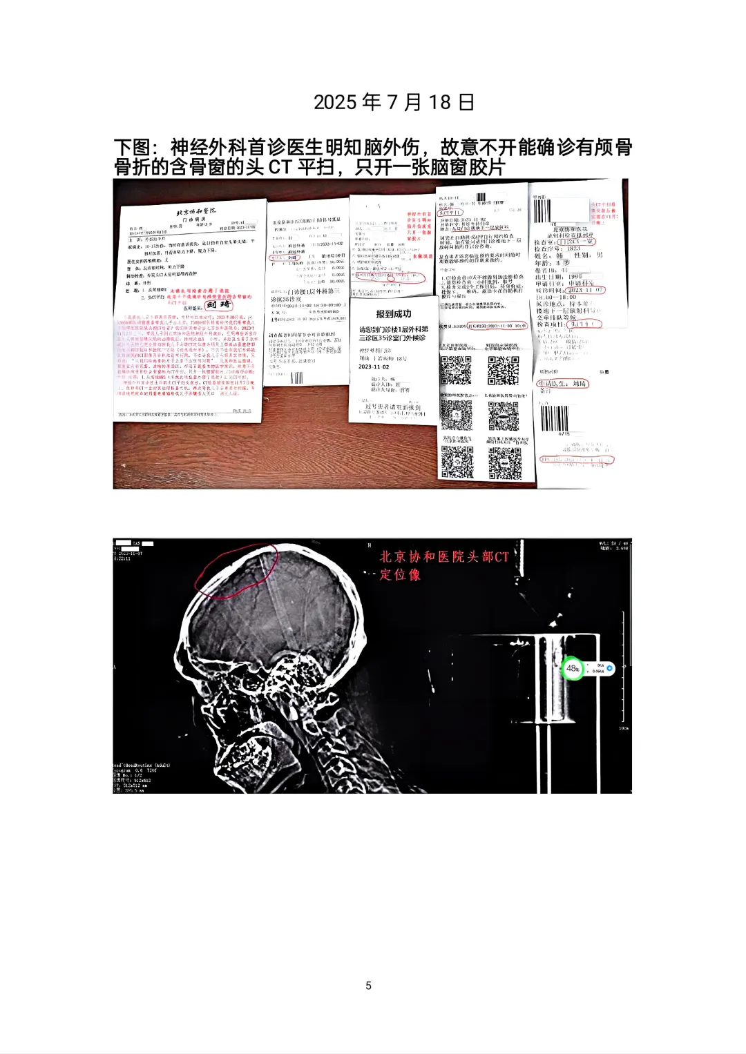 北京协和医院头部CT影像及诊断造假