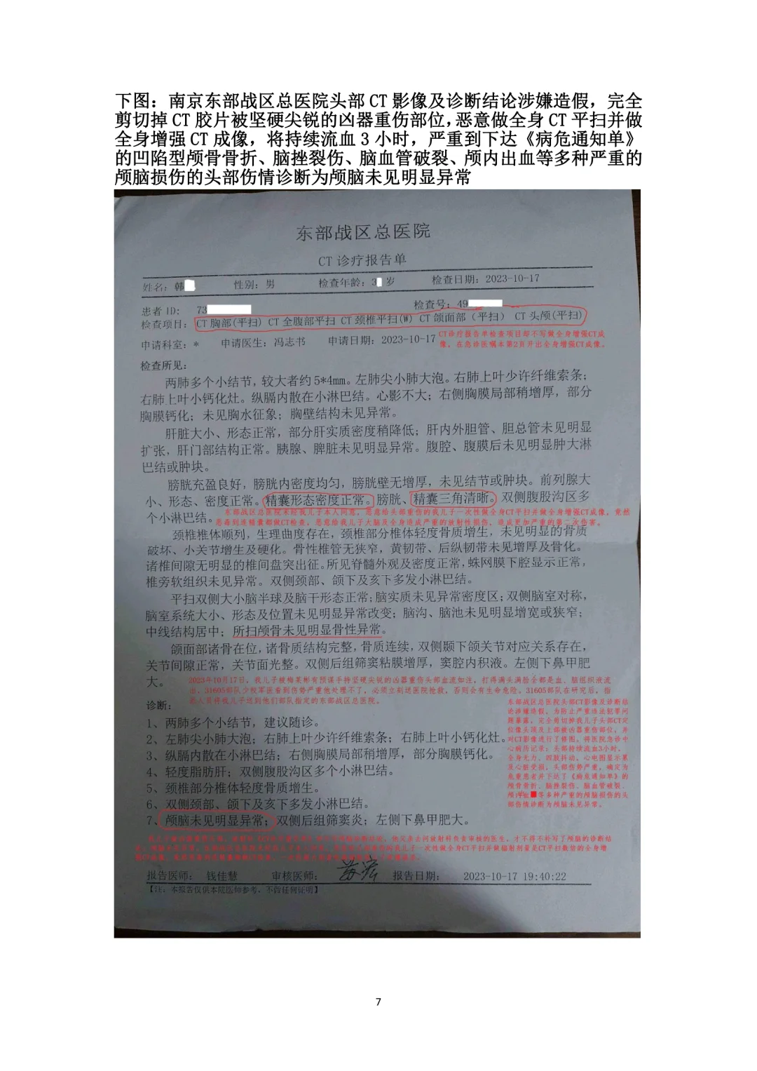 北京协和医院头部CT影像及诊断造假