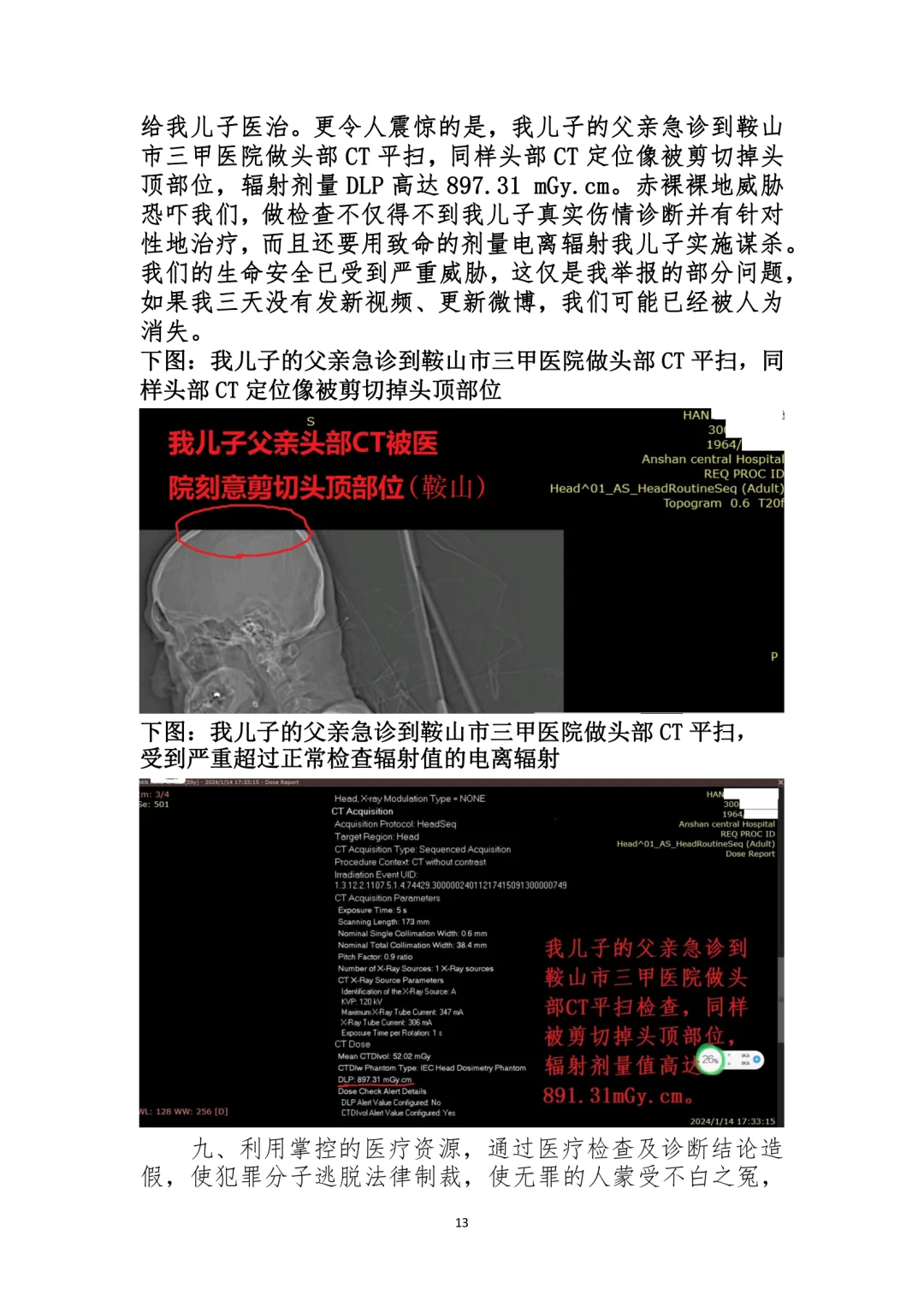 北京协和医院头部CT影像及诊断造假