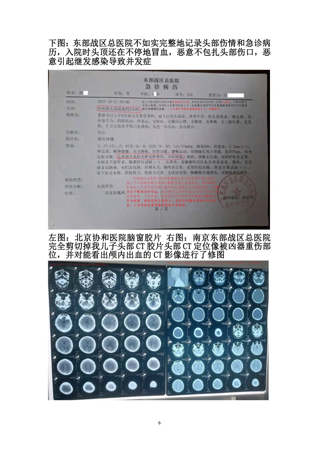 北京协和医院头部CT影像及诊断造假