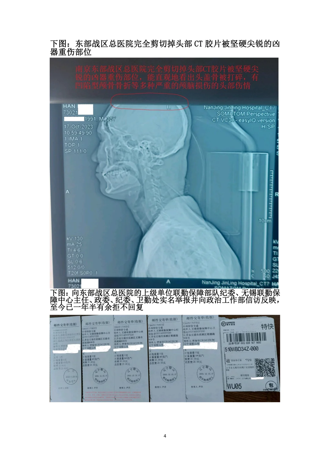 北京协和医院头部CT影像及诊断造假