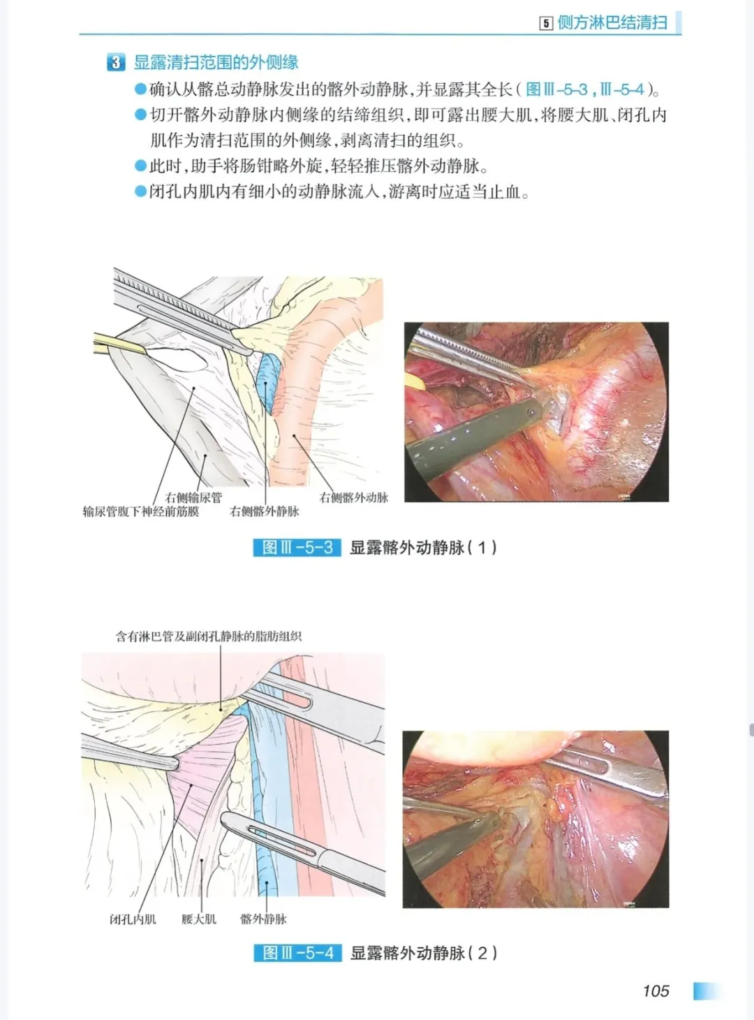 19本消化道外科学合集