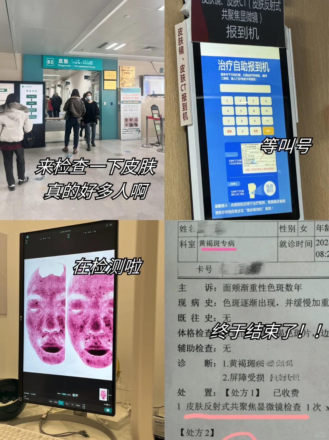 盘点600-700外开窗，常见问题