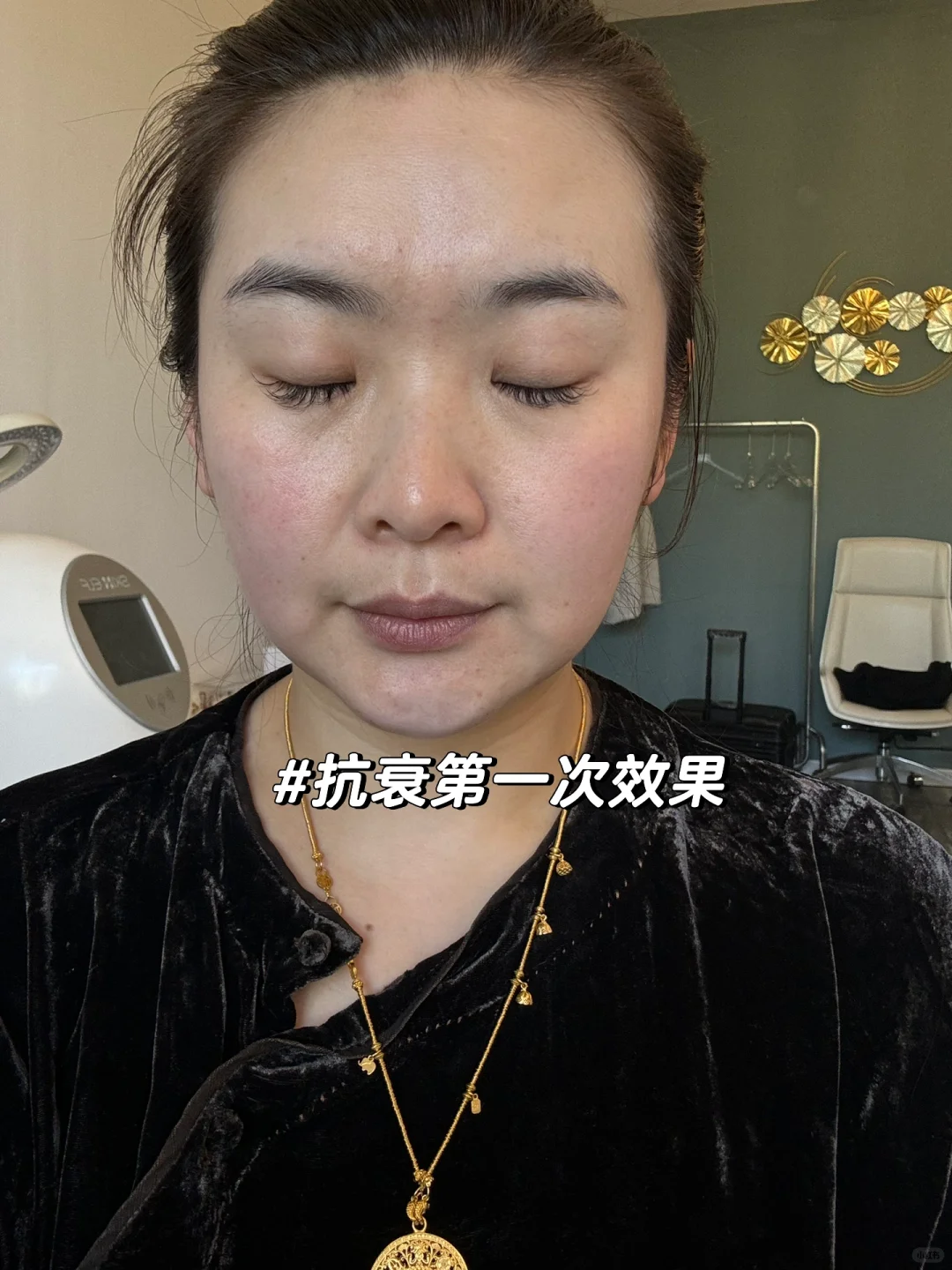 一个月的抗衰改变