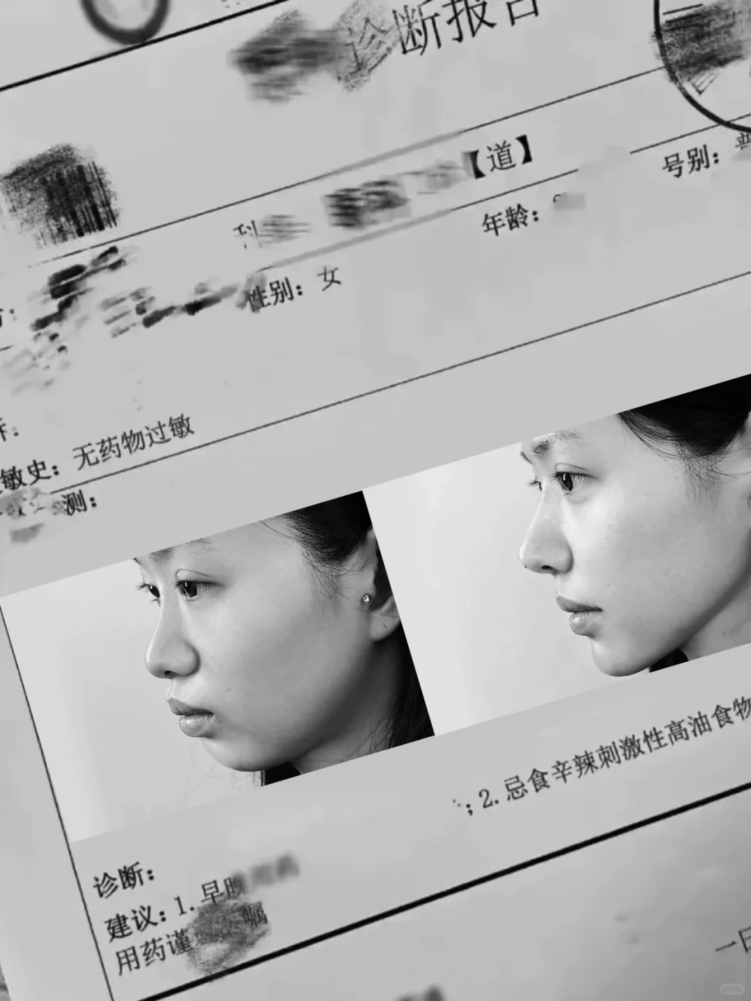 一旦做了正畸，这辈子就定型了