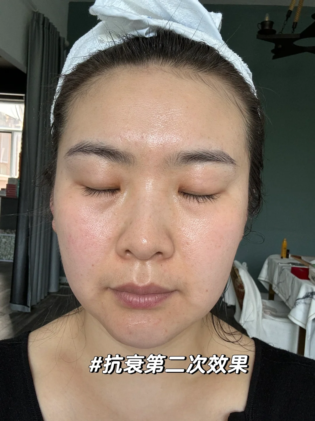 一个月的抗衰改变