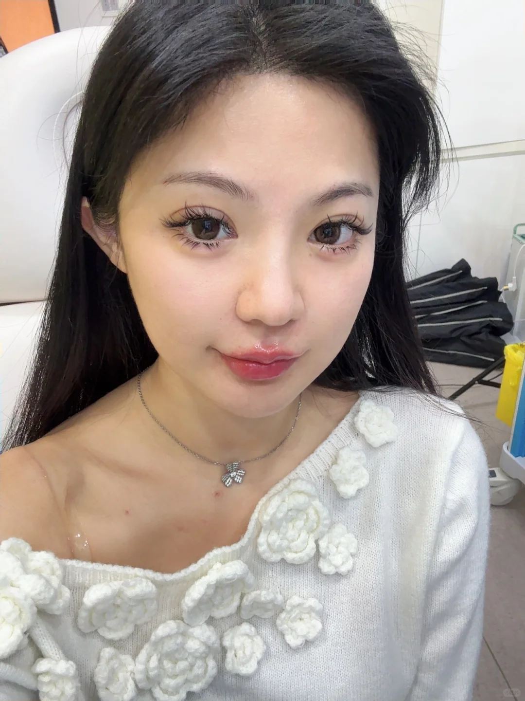 【变美日记】好喜欢好喜欢我的脸🥰