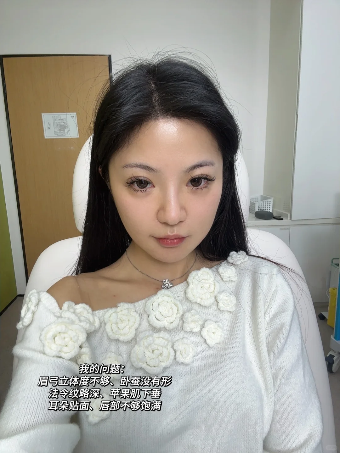 【变美日记】好喜欢好喜欢我的脸🥰