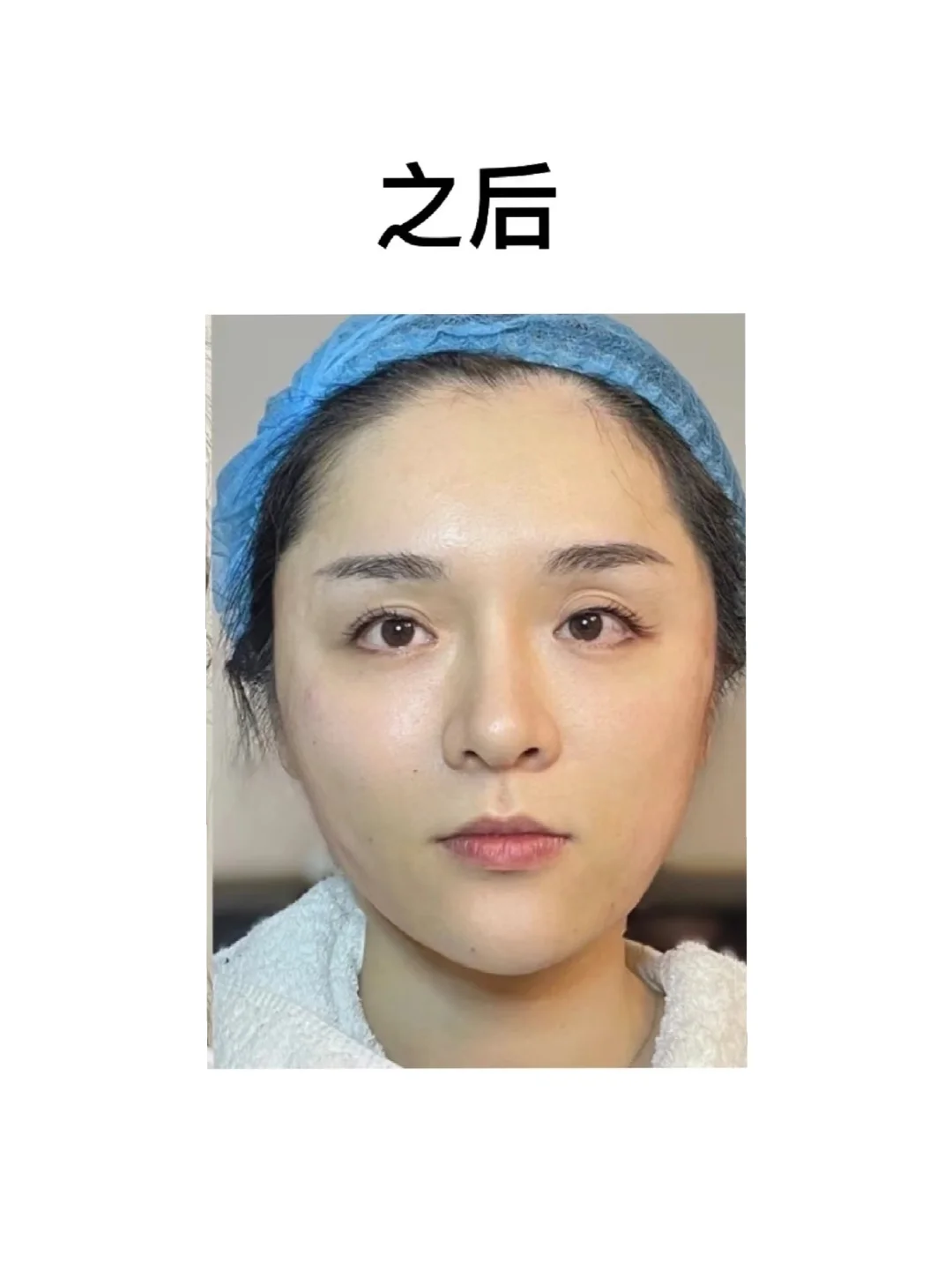 变美真的不难，右滑看我的变化