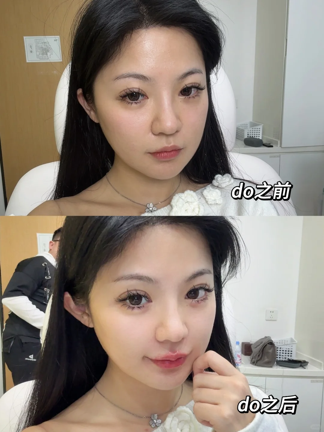 【变美日记】好喜欢好喜欢我的脸🥰