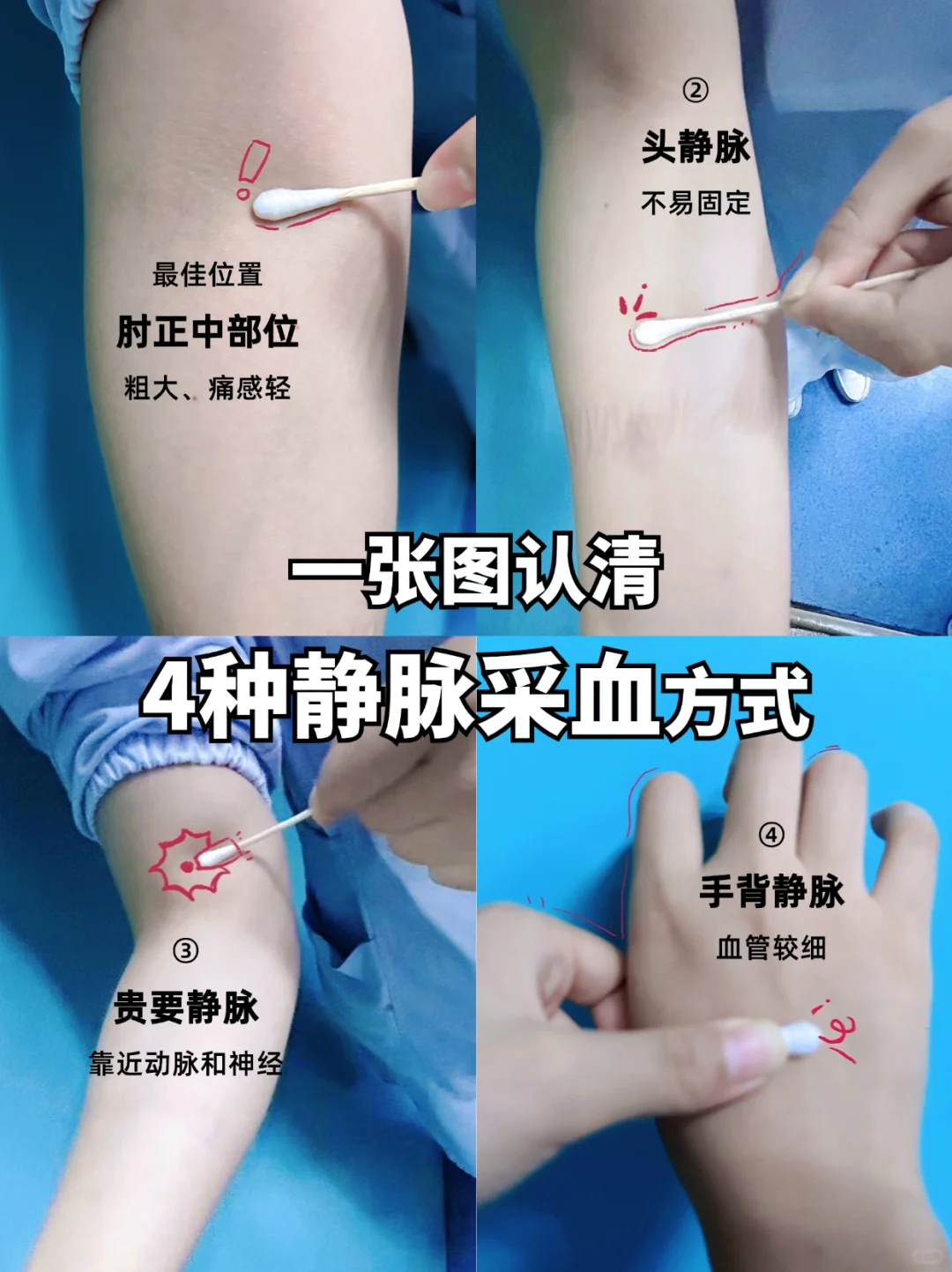 医院故事 | 抽血那点事，实习生一定要知道❗