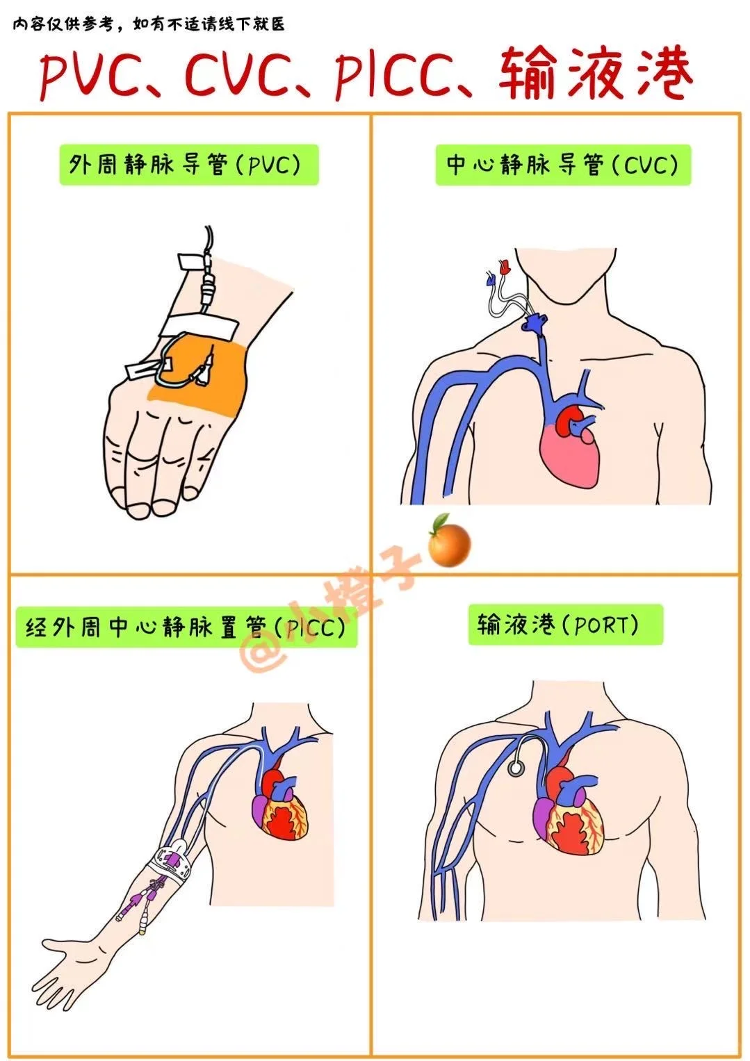 📖护士笔记｜PVC、CVC、PICC、PORT有什么区别❓