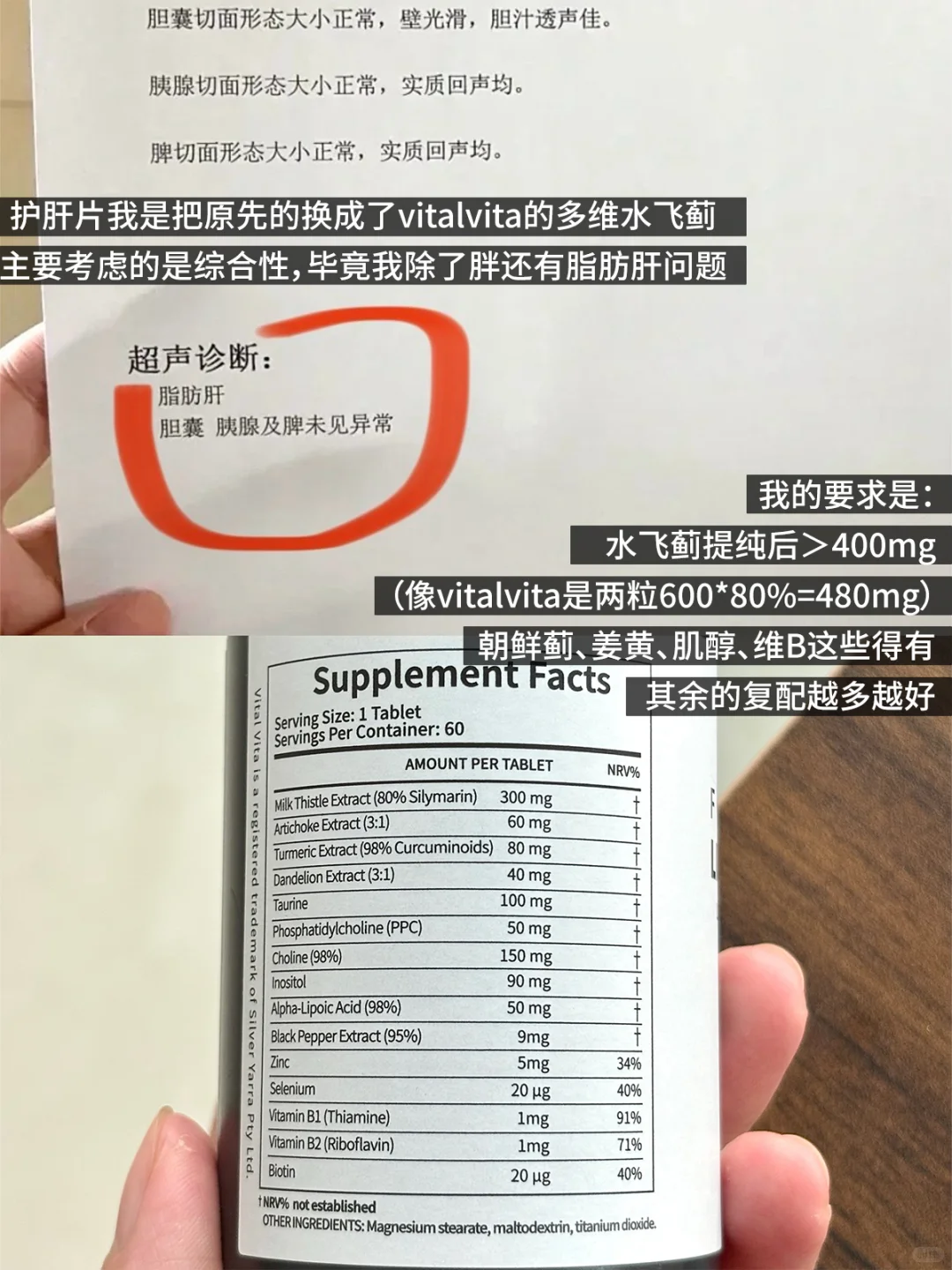 我的减重33斤经历(脂肪肝/胰岛素抵抗/多囊