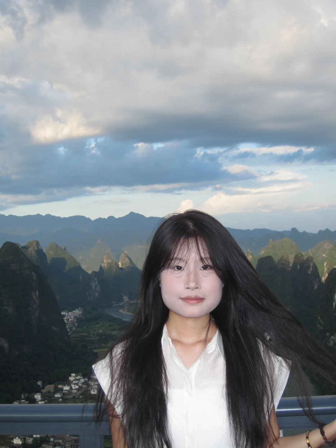 方圆脸打了瘦脸一年多的变化