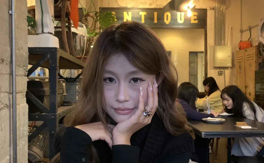 方圆脸打了瘦脸一年多的变化