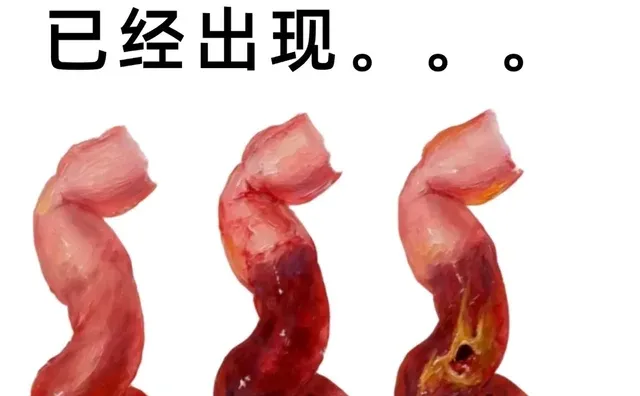 净水器第一批受害者已经出现了。。。