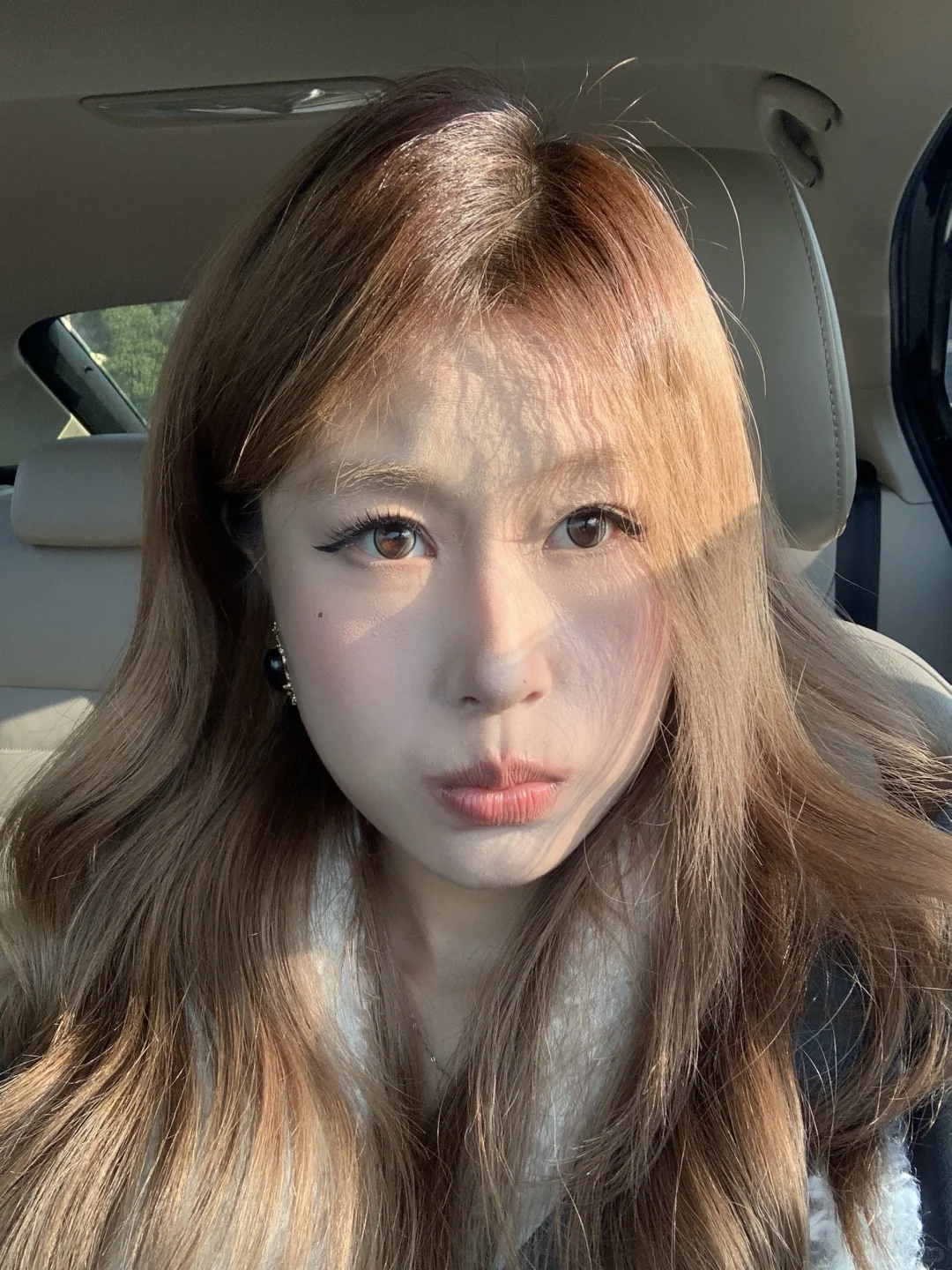 方圆脸打了瘦脸一年多的变化