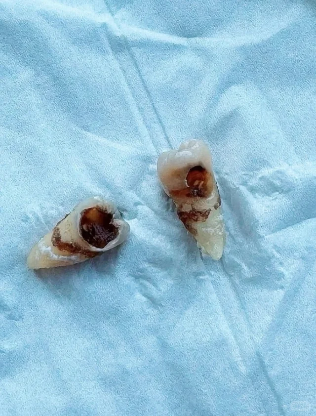 已离职，种牙能劝一个是一个吧……