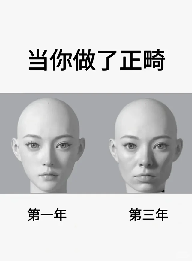 原来这才是正畸，很恶心🤢但很真实的内幕